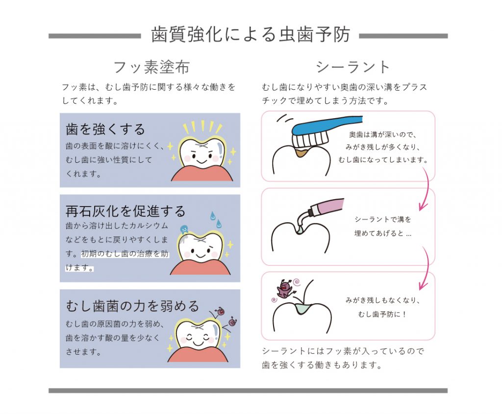 歯質強化による虫歯予防
