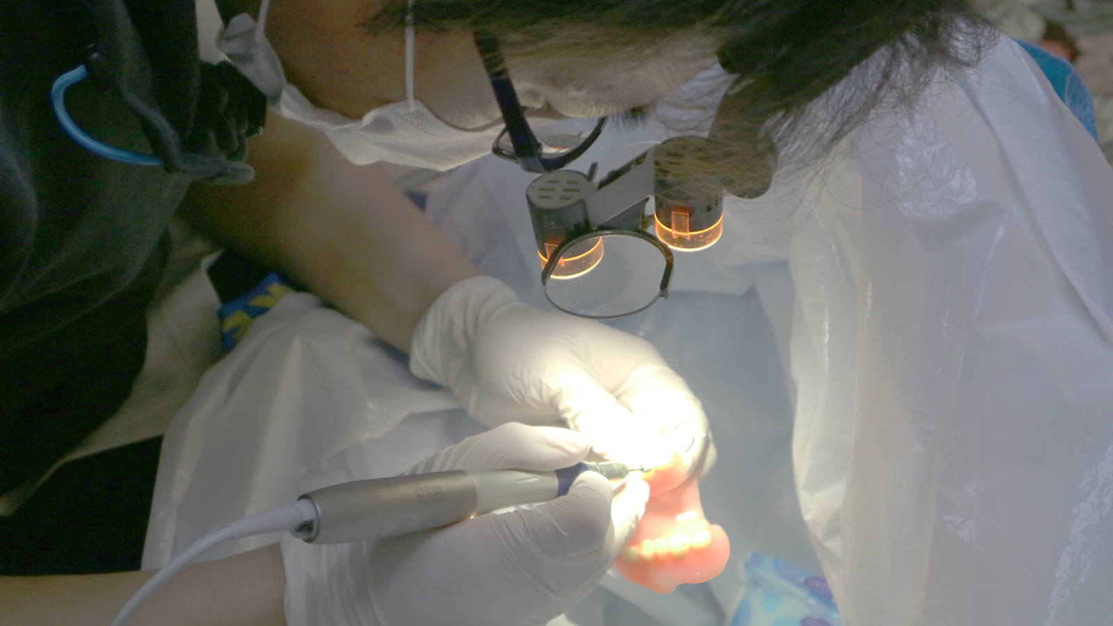 訪問診療　義歯