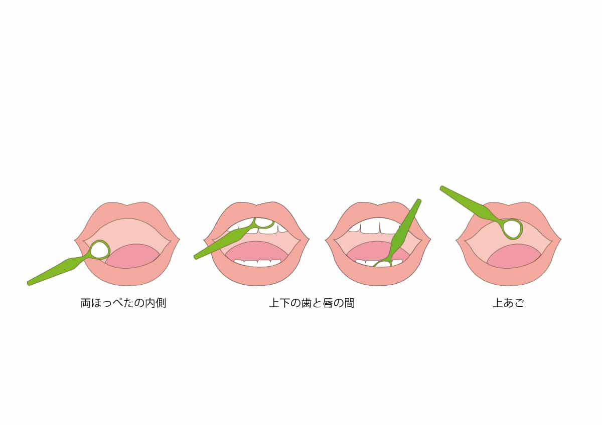 訪問診療コラム 舌ブラシの使い方 御笠川デンタルクリニック ヒカリ 大野城市の歯科医院